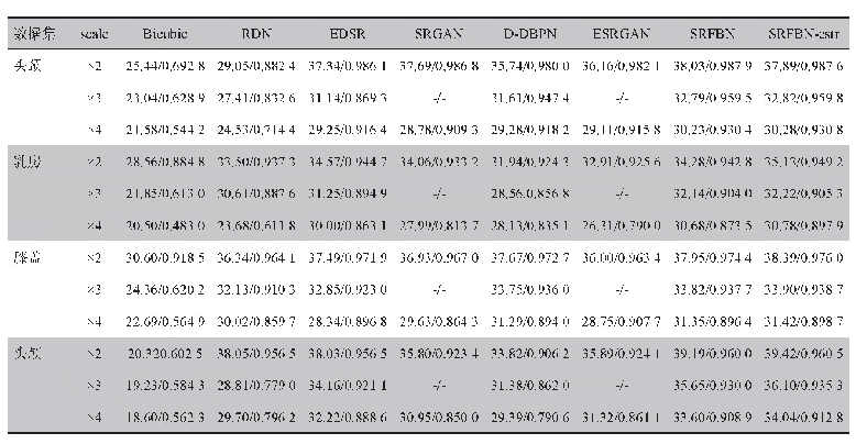 表5 MRI数据集在不同网络上的PSNR/SSIM
