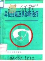 异位妊娠及其诊断治疗   1993  PDF电子版封面  780584223X  余凤霞等编著 