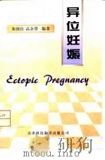 异位妊娠（1998 PDF版）