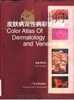 皮肤病及性病彩色图谱（1994 PDF版）
