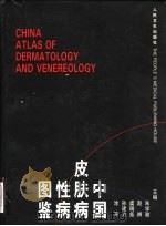 中国皮肤病性病图鉴   1998  PDF电子版封面  7117028955  朱学骏等主编 