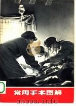 常用手术图解   1970  PDF电子版封面  14.4.122  上海第二医学院《常用手术图解》编写组编 