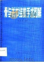 骨与关节结核手术图解   1984  PDF电子版封面    李培基 