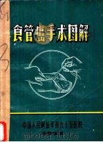 食管癌手术图解   1977  PDF电子版封面    中国人民解放军第九十五医院 