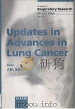 RPOGRESS IN RESPIRATORY RESEARCH  VOL.29  UPDATES IN ADVANCES IN LUNG CANCER     PDF电子版封面  3805565577  J.H.SCHILLER 