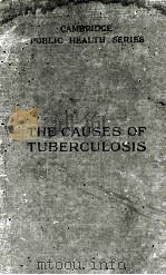 the causes of tuberculosis P707     PDF电子版封面     