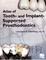 Atlas of Tooth-and Implant-Supported Prosthodontics     PDF电子版封面     