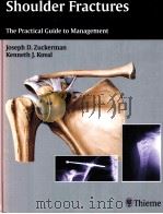 Shoulder Fractures  The Practical Guide to Management（ PDF版）