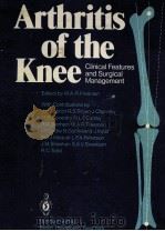 Arthritis of the Knee     PDF电子版封面     