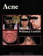 ACNE（1989 PDF版）