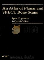 AN ATLAS OF PLANAR AND SPECT BONE SCANS   1989  PDF电子版封面  080163296X   