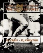 CLINICAL EXAMINATION OF THE INJURED KNEE   1987  PDF电子版封面  0683022423   