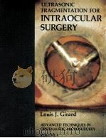 Ultrasonic fragmentation for intraocular surgery（1979 PDF版）