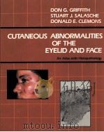 CUTANEOUS ABNORMALITIES OF THE EYELID AND FACE   1987  PDF电子版封面  0070247951  JACK W.PASSMORE ， CHARLES W.LE 