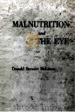 Malnutrition and the eye   1963  PDF电子版封面    Donald Stewart Mclaren 
