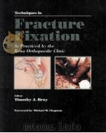 TECHNIQUES IN FRACTURE FIXATION AS PRACTICED BY THE RENO ORTHOPAEDIC CLINIC   1993  PDF电子版封面  039744690X  TIMOTHY J.BRAY 