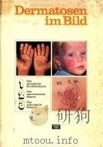 DERMATOSEN IM BILD   1970  PDF电子版封面     