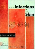 ATLAS OF INFECTIONS OF THE SKIN   1991  PDF电子版封面  0397448392  ANTHONY DU VIVIER 