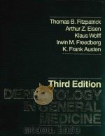 DERMATOLOGY IN GENERAL MEDICINE   1985  PDF电子版封面    THOMAS.B FITZPA 