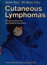 CUTANEOUS LYMPHOMAS   1983  PDF电子版封面    GUNTER BURG 