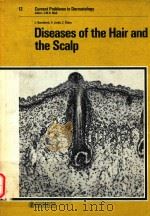 CURRENT PROBLEMS IN DERMATOLOGY (DISEASES OF THE HAIR AND THE SCALP)   1984  PDF电子版封面    J.W.H.MAIL 