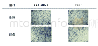 表3 transwell实验(×200)