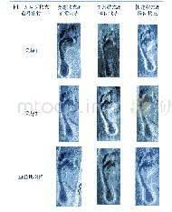 《表2 同一人两两状态下穿袜足迹抬痕形态特征图像效果比对表》