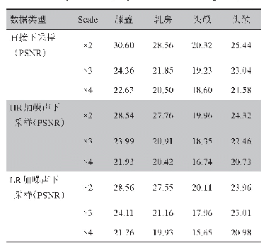 表3 高低分辨率对生成的PSNR(d B)